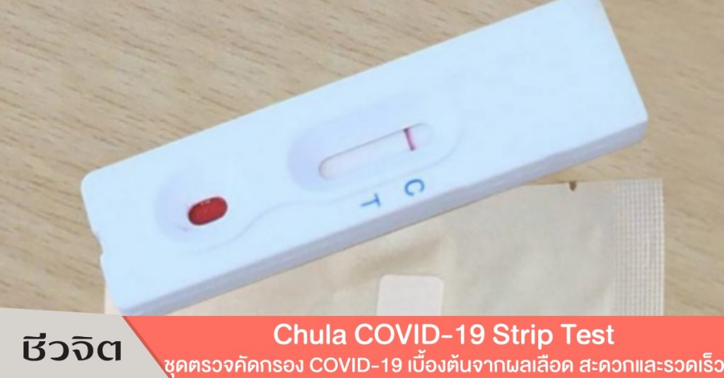 Chula COVID-19 Strip Test